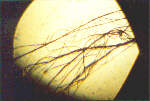 Fiberfden unter Mikroskop