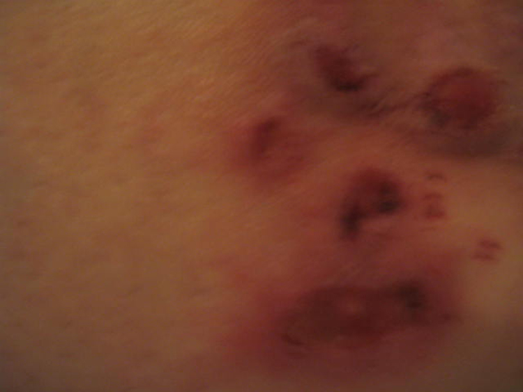 skin pics nov 3 2008 289